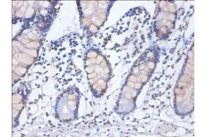Immunohistochemistry of paraffin-embedded human small intestine tissue using ABIN7155104 at dilution of 1:100 (HNRNPD/AUF1 抗体  (AA 18-355))