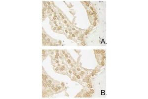 Immunohistochemistry (IHC) image for anti-V-Akt Murine Thymoma Viral Oncogene Homolog 3 (Protein Kinase B, Gamma) (AKT3) (Internal Region) antibody (ABIN1607681)