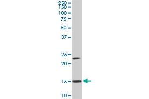 RPS17 monoclonal antibody (M01A), clone 2C7. (RPS17 抗体  (AA 36-135))
