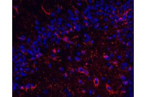 Immunofluorescence analysis of paraffin-embedded rat brain using GFAP Monoclonal Antibody at dilution of 1:400.