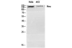 Western Blot (WB) analysis of HeLa 453 cells using Neu Polyclonal Antibody. (NEURL 抗体  (Ser357))