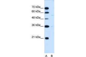 Western Blotting (WB) image for anti-Chromosome 19 Open Reading Frame 28 (C19orf28) antibody (ABIN2463998) (C19orf28 抗体)