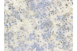 anti-erythrocyte Membrane Protein Band 4.9 (Dematin) (EPB49) (pSer403) antibody