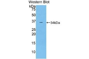 Western blot analysis of the recombinant protein. (TRAF5 抗体  (AA 181-437))
