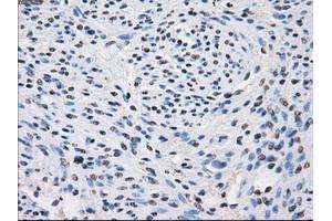 Immunohistochemical staining of paraffin-embedded colon tissue using anti-FHmouse monoclonal antibody. (FH 抗体)