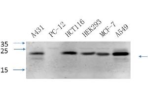anti-Caveolin 1, Caveolae Protein, 22kDa (CAV1) (AA 100-180) antibody