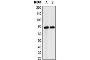 Western blot analysis of MASP2 expression in HeLa (A), SP2/0 (B) whole cell lysates. (MASP2 抗体  (Center))