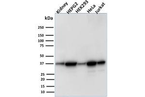 Western Blot Analysis of Human Kidney tissue, Human HepG2, HEK293, HeLa and Jurkat cell lysate using AKR1B1 Mouse Monoclonal Antibody (CPTC-AKR1B1-3). (AKR1B1 抗体)