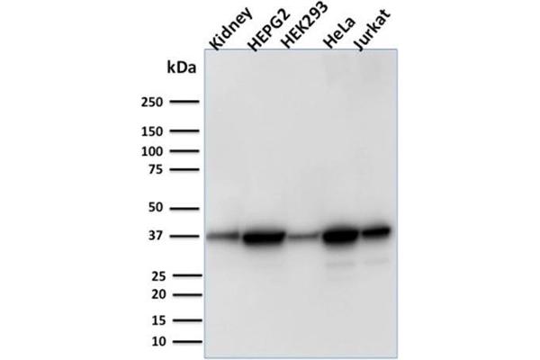 AKR1B1 anticorps