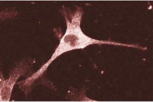 Immunofluorescence staining of human endothelial cells. (ENAH 抗体  (AA 415-541))