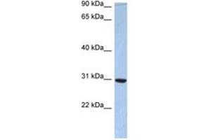 Image no. 1 for anti-PDZ Domain Containing 9 (PDZD9) (AA 73-122) antibody (ABIN6743866) (PDZD9 抗体  (AA 73-122))