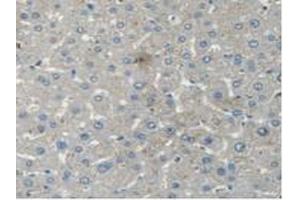 IHC-P analysis of Human Liver Tissue, with DAB staining. (STAM2 抗体  (AA 1-377))
