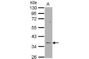 WB Image Sample (30 ug of whole cell lysate) A: H1299 10% SDS PAGE antibody diluted at 1:1000 (TYMS 抗体)