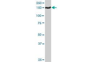 TMEM1 MaxPab rabbit polyclonal antibody. (TRAPPC10 抗体  (AA 1-1259))