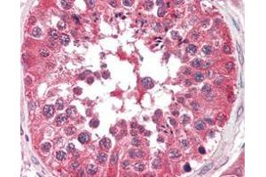 Immunohistochemical analysis of paraffin-embedded human testis tissues using BRAF mouse mAb. (BRAF 抗体)