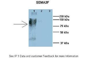 Immunoprecipitation (IP) image for anti-Sema Domain, Immunoglobulin Domain (Ig), Short Basic Domain, Secreted, (Semaphorin) 3F (SEMA3F) (N-Term) antibody (ABIN2786778)