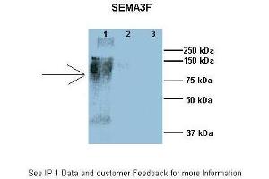 Researcher: Dr. (SEMA3F 抗体  (N-Term))