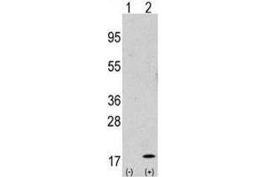 Western blot analysis of GABARAP antibody and 293 cell lysate either nontransfected (Lane 1) or transiently transfected with the GABARAP gene (2). (GABARAP 抗体  (AA 1-30))