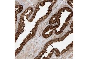 Immunohistochemical staining of human prostate with SCARF2 polyclonal antibody  strong cytoplasmic positivity in glandular cells at 1:200-1:500 dilution. (SCARF2 抗体)