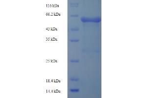 SDS-PAGE (SDS) image for Matrix Metallopeptidase 3 (Stromelysin 1, Progelatinase) (MMP3) (AA 102-477), (partial) protein (His-SUMO Tag) (ABIN5709947) (MMP3 Protein (AA 102-477, partial) (His-SUMO Tag))