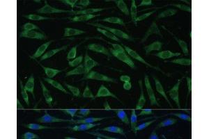 Immunofluorescence analysis of L929 cells using DNM3 Polyclonal Antibody at dilution of 1:100 (40x lens). (Dynamin 3 抗体)