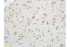 Formalin-fixed and paraffin embedded rat brain tissue labeled with Anti-Phospho-TrkA (Tyr490) /TrkB (Tyr516) Polyclonal Antibody, Unconjugated (ABIN746603) at 1:200, followed by conjugation to the secondary antibody and DAB staining (TRKA 抗体  (pTyr496))