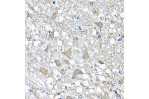 Immunohistochemistry of paraffin-embedded rat brain using VPS37A antibody (ABIN5975733) at dilution of 1/100 (40x lens). (VPS37A 抗体)