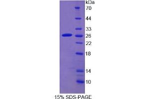 SDS-PAGE analysis of Human CYP2D6 Protein. (CYP2D6 蛋白)