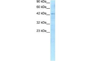 Western Blotting (WB) image for anti-Recombination Signal Binding Protein For Immunoglobulin kappa J Region (RBPJ) (C-Term) antibody (ABIN2777213)