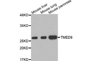 Western blot analysis of extracts of various cell lines, using TMED9 antibody. (TMED9 抗体)