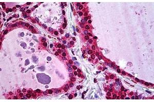 Human Thyroid: Formalin-Fixed, Paraffin-Embedded (FFPE) (ATF5 抗体  (AA 101-200))
