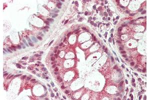 Rabbit Anti-TSC22D1 antibody Catalog Number: ARP36279 Formalin Fixed Paraffin Embedded Tissue: Human Colon Primary antibody Concentration: 1:100 Secondary Antibody: Donkey anti-Rabbit-Cy3 Secondary Antibody Concentration: 1:200 Magnification: 20x Exposure Time: 0. (TSC22D1 抗体  (C-Term))