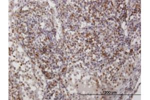 Immunoperoxidase of purified MaxPab antibody to CD2 on formalin-fixed paraffin-embedded human lymph node. (CD2 抗体  (AA 1-351))