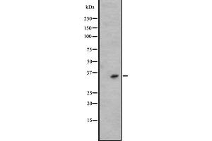 Western blot analysis of KLK6 expression in A431 whole cell lysate ,The lane on the left is treated with the antigen-specific peptide. (Kallikrein 6 抗体  (C-Term))