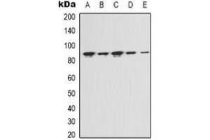 Western blot analysis of FAP alpha expression in Hela (A), MCF7 (B), NIH3T3 (C), mouse kidney (D), rat liver (E) whole cell lysates. (FAP 抗体)