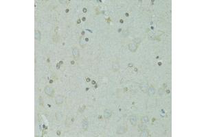 Immunohistochemistry of paraffin-embedded rat brain using GTF2H2C antibody (ABIN5973022) at dilution of 1/100 (40x lens). (GTF2H2C 抗体)