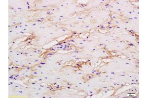 Formalin-fixed and paraffin embedded human colon labeled with Rabbit Anti phospho-LRP1(Ser4523) Polyclonal Antibody, Unconjugated (ABIN801648) at 1:200 followed by conjugation to the secondary antibody and DAB staining (LRP1 抗体  (pSer4523))