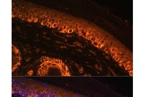 Immunofluorescence analysis of Rat skin using TYR Polyclonal Antibody at dilution of 1:100. (TYR 抗体)