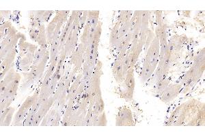 Immunohistochemistry (IHC) image for anti-Interleukin 18 (IL18) (AA 37-193) antibody (ABIN7426994)
