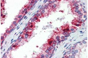 Human Prostate (formalin-fixed, paraffin-embedded) stained with BCL11A antibody ABIN462216 followed by biotinylated goat anti-rabbit IgG secondary antibody ABIN481713, alkaline phosphatase-streptavidin and chromogen. (BCL11A 抗体  (N-Term))