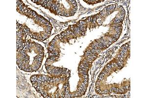 IHC analysis of TIMM29 using anti-TIMM29 antibody (ABIN7601495). (TIMM29 抗体  (AA 37-260))