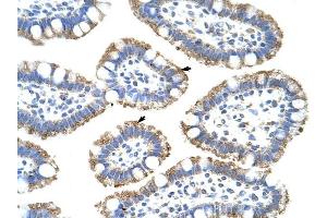 SF3B4 antibody was used for immunohistochemistry at a concentration of 4-8 ug/ml to stain Epithelial cells of intestinal villus (arrows) in Human Intestine. (SF3B4 抗体  (N-Term))