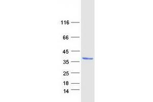 Validation with Western Blot