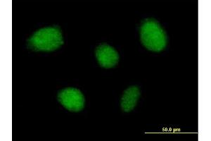 Immunofluorescence of purified MaxPab antibody to TNIP1 on HeLa cell. (TNIP1 抗体  (AA 1-636))