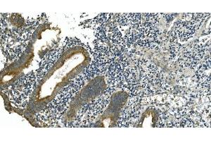 IHC analysis of CDC123 using anti-CDC123 antibody (ABIN7599284).