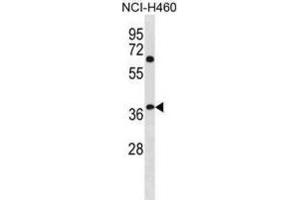 Western Blotting (WB) image for anti-NHL Repeat Containing 3 (NHLRC3) antibody (ABIN3001284) (NHLRC3 抗体)