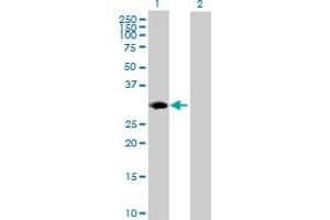 Western Blot analysis of PSMB8 expression in transfected 293T cell line by PSMB8 MaxPab polyclonal antibody. (PSMB8 抗体  (AA 1-272))