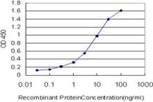 Detection limit for recombinant GST tagged CRX is approximately 0. (CRX 抗体  (AA 1-95))