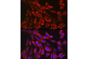 Immunofluorescence analysis of NIH/3T3 cells using Collagen III alpha 1/COL3 antibody (ABIN7266459) at dilution of 1:100. (COL3 抗体)