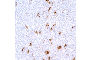 Immunohistochemistry (IHC) image for anti-CD68 Molecule (CD68) antibody (ABIN7449045)